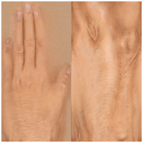 arm texture